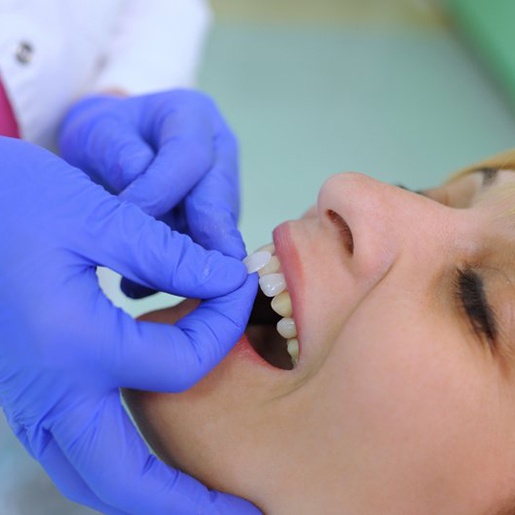 Lady receives dental veneers